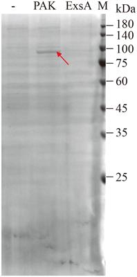 MvaT binds to the PexsC promoter to repress the type III secretion system in Pseudomonas aeruginosa